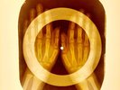 USSR X-RAY HANDS ROENTGEN BONES RECORD ORIGINAL OLD RIBS 883