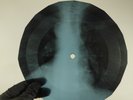 ELTON JOHN IT'S ME THAT YOU NE\ X-Ray USSR Record Roentgen Bone Ribs Music Vinyl
