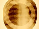 X-RAY USSR ROENTGEN BONES RECORD ORIGINAL OLD RIBS 878