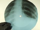 BOB DYLAN TEMPORARY LIKE ACHILE X-Ray USSR Record Roentgen Bone Ribs Music Vinyl