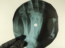 STRING A LONGS WHEELS X-Ray USSR Record Roentgen Bone Ribs Music Vinyl