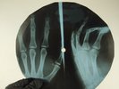 LED ZEPPELIN HOW MANY MORE TIME X-Ray USSR Record Roentgen Bone Ribs Music Vinyl