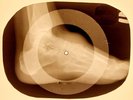 USSR X-RAY FOOT  ROENTGEN BONES RECORD ORIGINAL OLD RIBS 859
