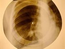 X-RAY USSR ROENTGEN BONES RECORD ORIGINAL OLD RIBS 862