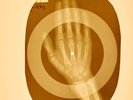 USSR X-RAY HAND ROENTGEN BONES RECORD 78 rpm ORIGINAL OLD RIBS 876