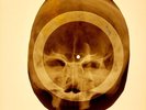 X-RAY SKULL USSR  ROENTGEN BONES RECORD ORIGINAL OLD RIBS 871