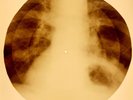 X-RAY USSR ROENTGEN BONES RECORD ORIGINAL OLD RIBS 902