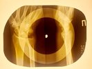 USSR X-RAY HAND ROENTGEN BONES RECORD ORIGINAL OLD RIBS 894