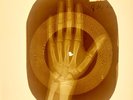 USSR X-RAY HAND ROENTGEN BONES RECORD ORIGINAL OLD RIBS 899