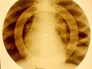 X-RAY USSR ROENTGEN BONES RECORD ORIGINAL OLD RIBS 911
