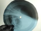 PINK FLOYD APPLES & ORANGES X-Ray USSR Record Roentgen Bones Ribs Music Vinyl