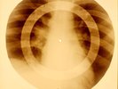 X-RAY USSR ROENTGEN BONES RECORD ORIGINAL OLD RIBS 925