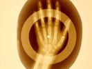 USSR X-RAY HAND ROENTGEN BONES RECORD ORIGINAL OLD RIBS 917