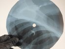 DION THE WANDERER X-Ray USSR Record Roentgen Bone Ribs Music Vinyl