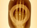 USSR X-RAY HAND ROENTGEN BONES RECORD ORIGINAL OLD RIBS 943