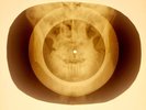 USSR X-RAY SKULL ROENTGEN BONES RECORD ORIGINAL OLD RIBS 936