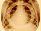 X-RAY CHILD USSR ROENTGEN BONES RECORD ORIGINAL OLD RIBS 940