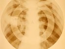 X-RAY USSR ROENTGEN BONES RECORD ORIGINAL OLD RIBS 938