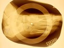 USSR  X-RAY  FOOT ROENTGEN BONES RECORD ORIGINAL OLD RIBS 945
