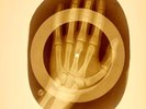 USSR X-RAY HAND ROENTGEN BONES RECORD ORIGINAL OLD RIBS 946