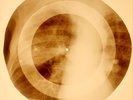 X-RAY USSR ROENTGEN BONES RECORD ORIGINAL OLD RIBS 921