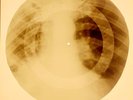 X-RAY USSR ROENTGEN BONES RECORD ORIGINAL OLD RIBS 932