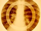 X-RAY USSR ROENTGEN BONES RECORD ORIGINAL OLD RIBS 956