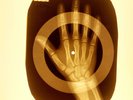 USSR X-RAY HAND ROENTGEN BONES RECORD ORIGINAL OLD RIBS 976