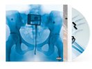 LORDE  - VIRGIN- EXCLUSIVE  X-RAY PICTURE DISC WITH SIGNED INSERT Pre Order