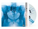 AUTOGRAPHED SIGNED Lorde VIRGIN GATEFOLD Presale X-Ray Picture Disc Vinyl LP