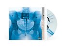 AUTOGRAPHED SIGNED Lorde VIRGIN GATEFOLD Presale X-Ray Picture Disc Vinyl LP