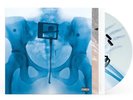 AUTOGRAPHED SIGNED Lorde VIRGIN GATEFOLD Presale X-Ray Picture Disc Vinyl LP
