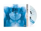 PRE-SALE: SIGNED art card & x-ray picture disc vinyl - Virgin, Lorde