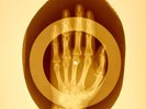 USSR X-RAY HAND ROENTGEN BONES RECORD ORIGINAL OLD RIBS 971