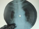 LED ZEPPELIN GALLOWS POLE X-Ray USSR Record Roentgen Bone Ribs Music Vinyl