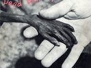 Dead Kennedys - Plastic Surgery Disasters Vinyl, LP, Album, ISS Pressing