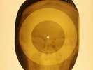USSR X-RAY SKULL ROENTGEN BONES RECORD ORIGINAL OLD RIBS 981