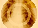 X-RAY USSR ROENTGEN BONES RECORD ORIGINAL OLD RIBS 950