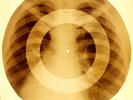 X-RAY USSR ROENTGEN BONES RECORD ORIGINAL OLD RIBS 998
