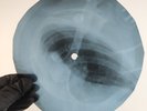 DAVID BOWIE QUEEN BITCH X-Ray USSR Record Roentgen Bone Ribs Music Vinyl