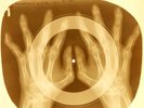USSR X-RAY HANDS ROENTGEN BONES RECORD ORIGINAL OLD RIBS 31
