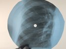 ROLLING STONES EMPTY HEART X-Ray USSR Record Roentgen Bone Ribs Music Vinyl