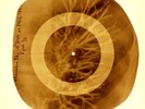X-RAY USSR ROENTGEN BONES RECORD ORIGINAL OLD RIBS 24