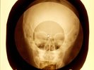 USSR X-RAY SKULL ROENTGEN BONES RECORD ORIGINAL OLD RIBS 18