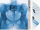 Lorde Signed Autographed Virgin Gatefold X-Ray Picture Disc Vinyl LP