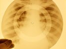 X-RAY USSR ROENTGEN BONES RECORD ORIGINAL OLD RIBS 45