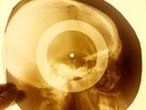 USSR X-RAY SKULL ROENTGEN BONES RECORD ORIGINAL OLD RIBS 39