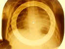 X-RAY CHILD USSR ROENTGEN BONES RECORD ORIGINAL OLD RIBS 36