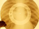X-RAY USSR ROENTGEN BONES RECORD ORIGINAL OLD RIBS 43