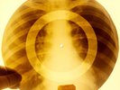 X-RAY USSR ROENTGEN BONES RECORD ORIGINAL OLD RIBS 37